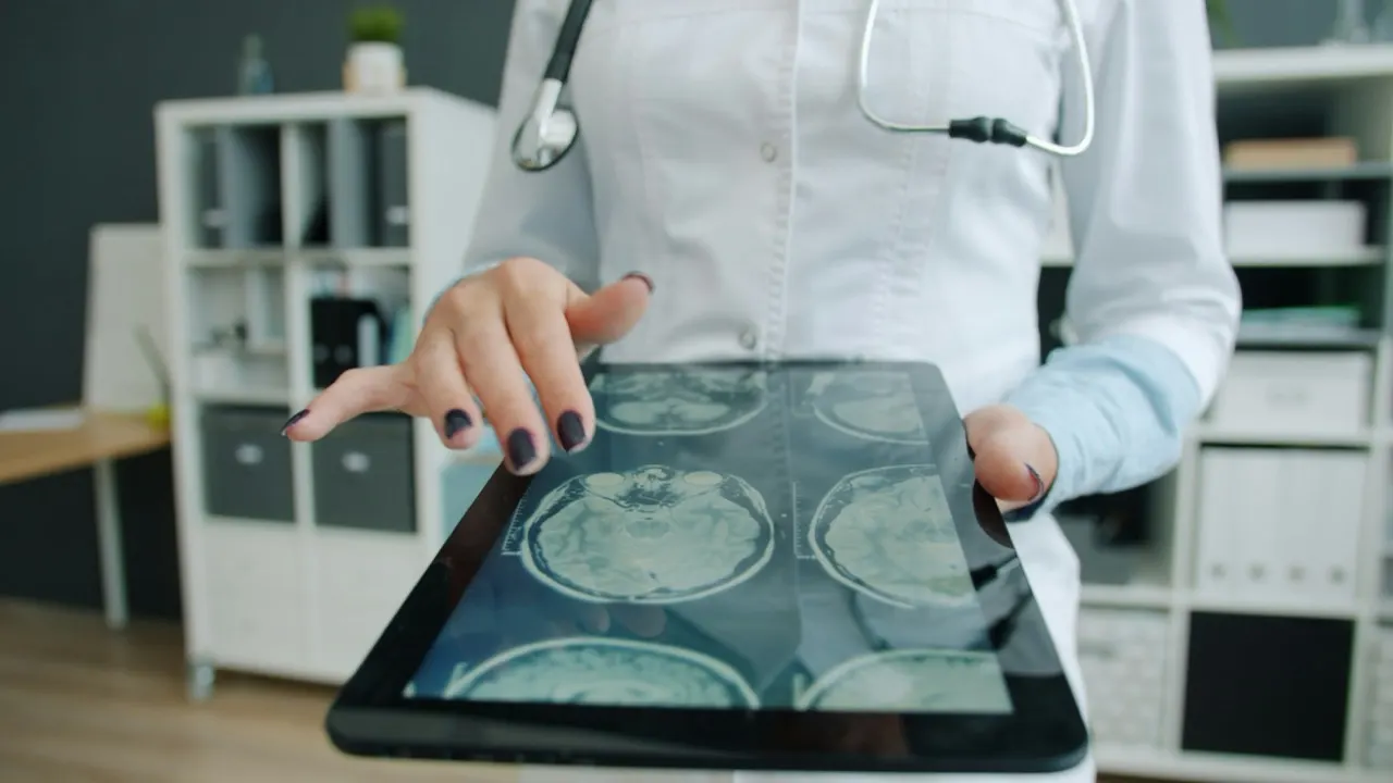 Clinician reviewing brain scans on a tablet